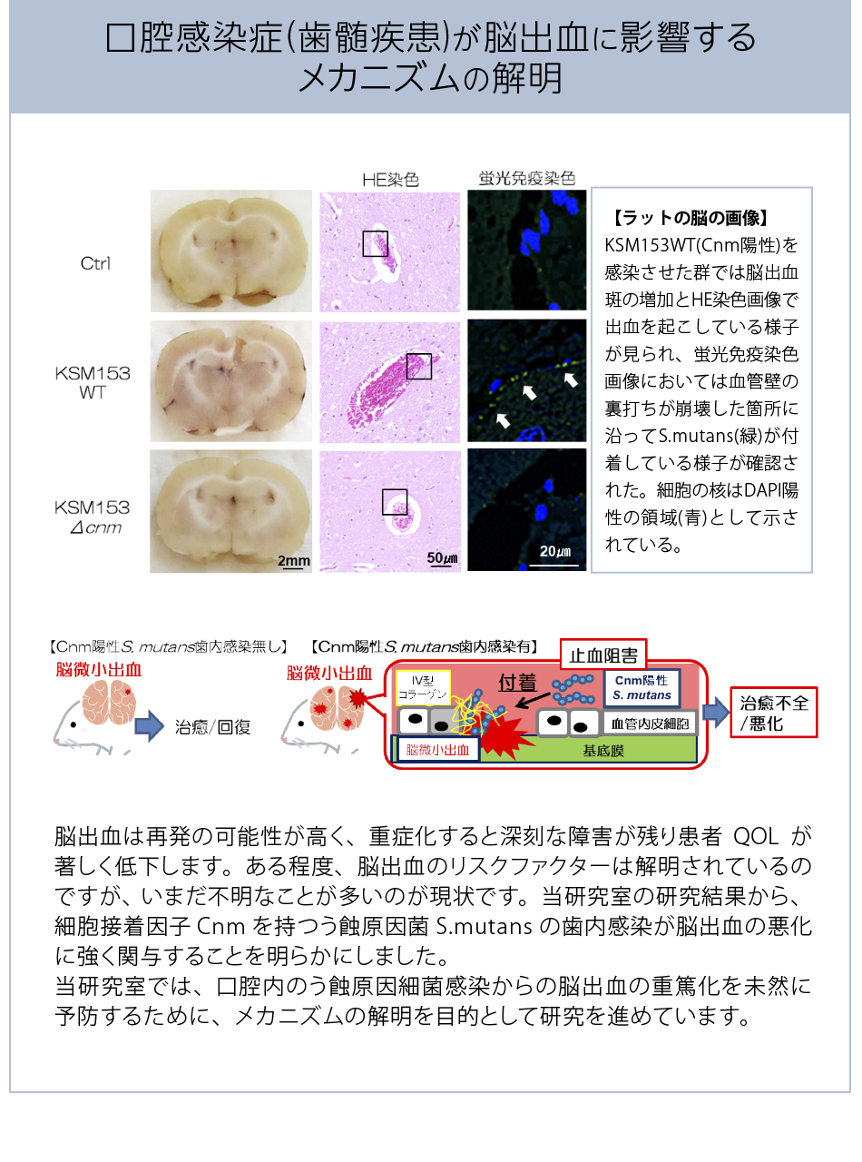 研究内容２