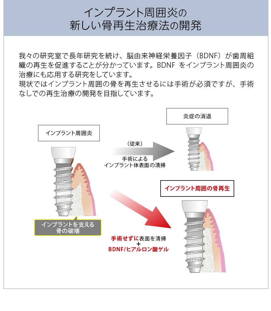 研究内容4